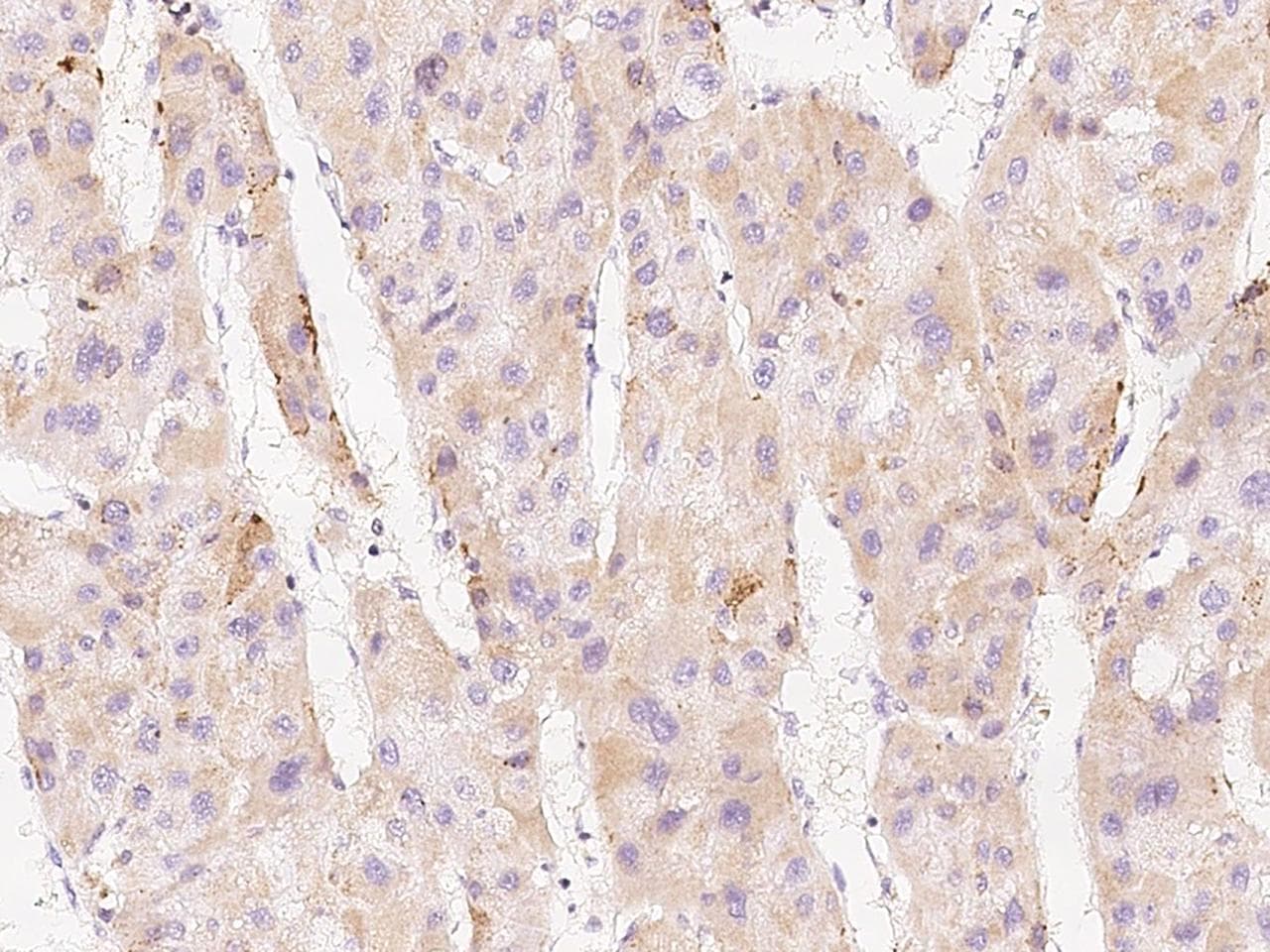 FACL2 / ACSL1 Antibody