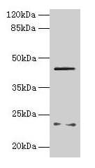 FIBP Antibody (aa2-357)