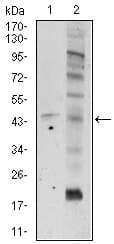 Monoclonal Mouse anti-Human FZD5 / Frizzled 5 Antibody (clone 2D12, WB)