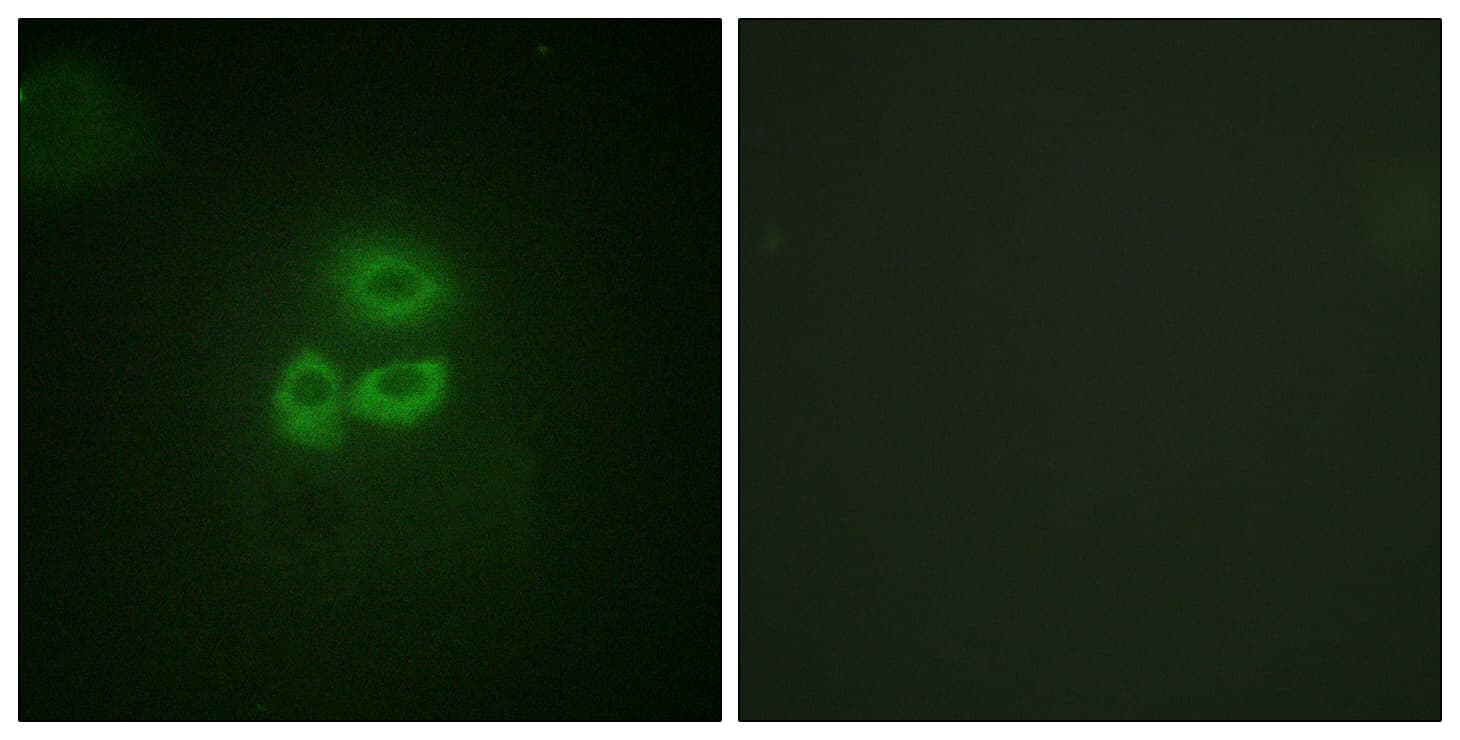 IHC-plus™ PRKD1 / PKC Mu Antibody (aa171-220)