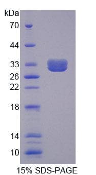 Mouse TNFRSF1B / TNFR2 Protein (Recombinant His)