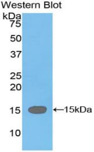 TTR / Transthyretin Antibody (aa22-147)