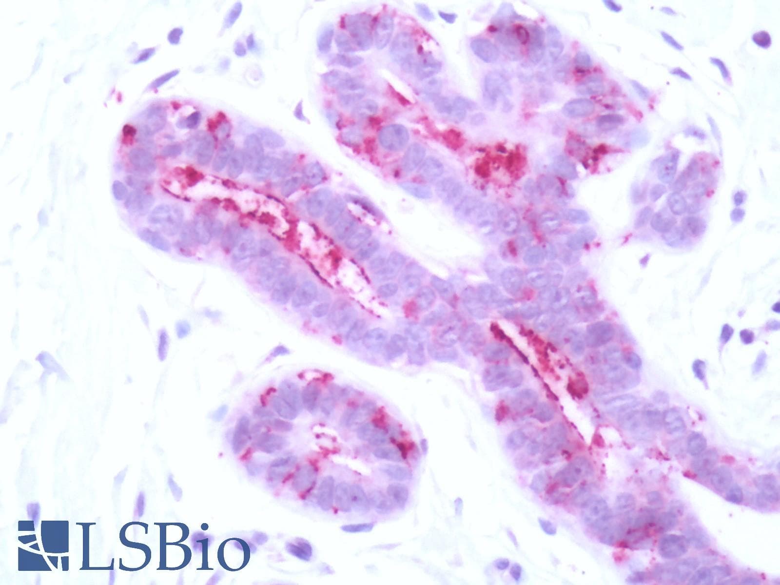 IHC-plus™ Polyclonal Rabbit anti-Human F2RL2 / PAR3 Antibody (C-Terminus, IHC)