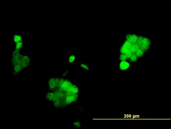 Monoclonal Mouse anti-Human PR / Progesterone Receptor Antibody (clone 2C2, IHC, IF, WB)