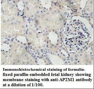 AP50 / AP2M1 Antibody (aa11-215)