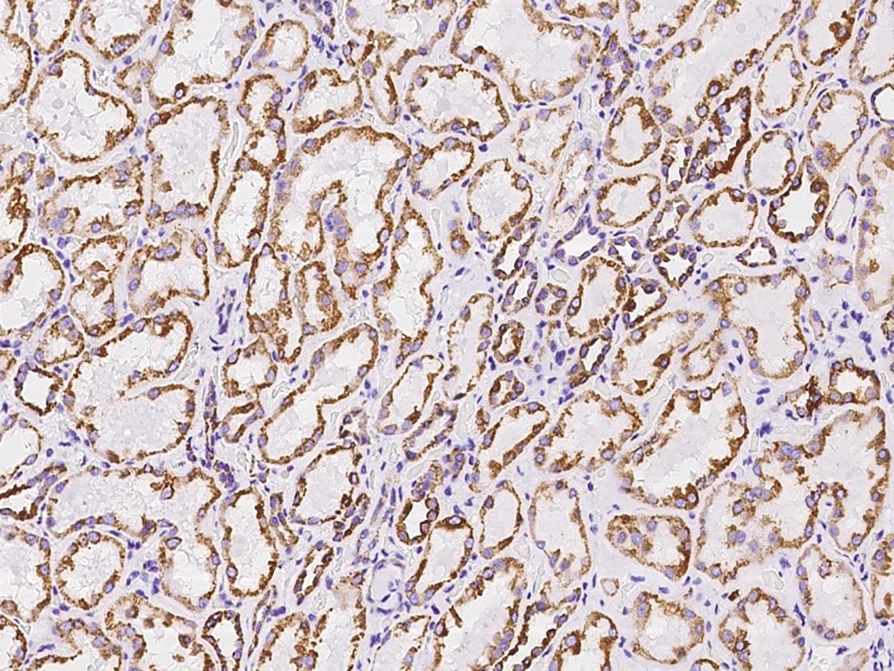 Polyclonal Rabbit anti-Human VDAC2 Antibody (IHC, IF, WB)