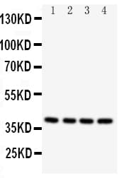 Polyclonal Rabbit anti-Human CASP12 / Caspase 12 Antibody (aa71-84, IHC, WB)