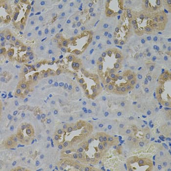 Polyclonal Rabbit anti-Human ARF1 Antibody (IHC, WB)