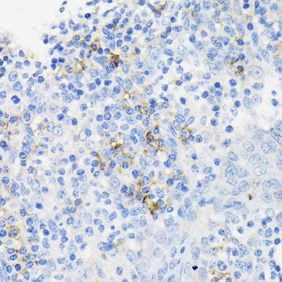 LL37 / Cathelicidin Antibody
