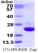Human RAB24 Protein (Recombinant His)