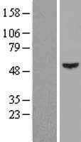 Human KRT16 / CK16 / Cytokeratin 16 Protein (Over-Expression Lysate Myc-DDK (Flag))
