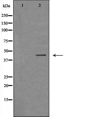 IL2RG / CD132 Antibody