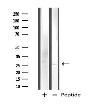 Polyclonal Rabbit anti-Human FAM3D Antibody (IHC, IF, WB)