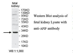 APIP Antibody (aa2-156)