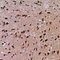 Polyclonal Rabbit anti-Human SAFB2 Antibody (IHC, WB)