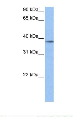 Polyclonal Rabbit anti-Human NUDC Antibody (aa124-173, IHC, WB)