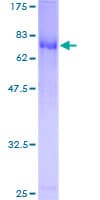 Human E2F8 Protein (Recombinant GST)