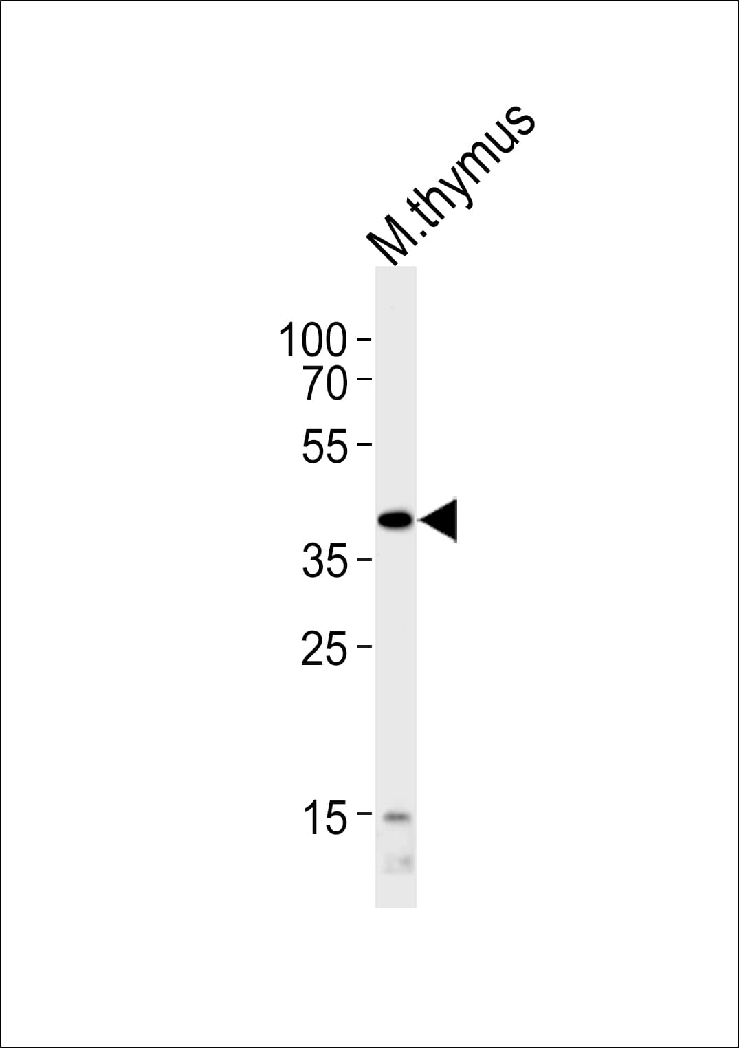 Polyclonal Rabbit anti-Mouse TFAP2A / AP-2 Antibody (aa134-166, WB)