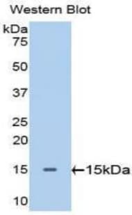 GPT / Alanine Transaminase Antibody (aa147-263, APC, Cy7)