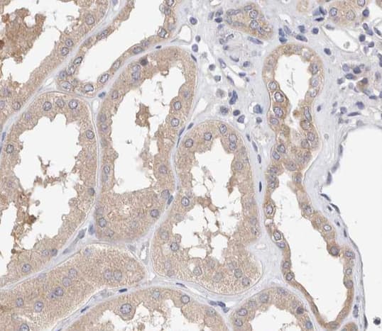 SMAD3 Antibody (phospho-Ser425)