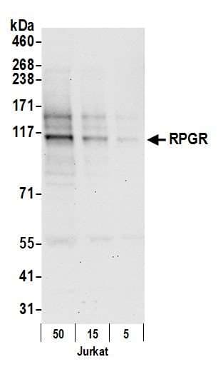 RPGR Antibody (aa825-875)