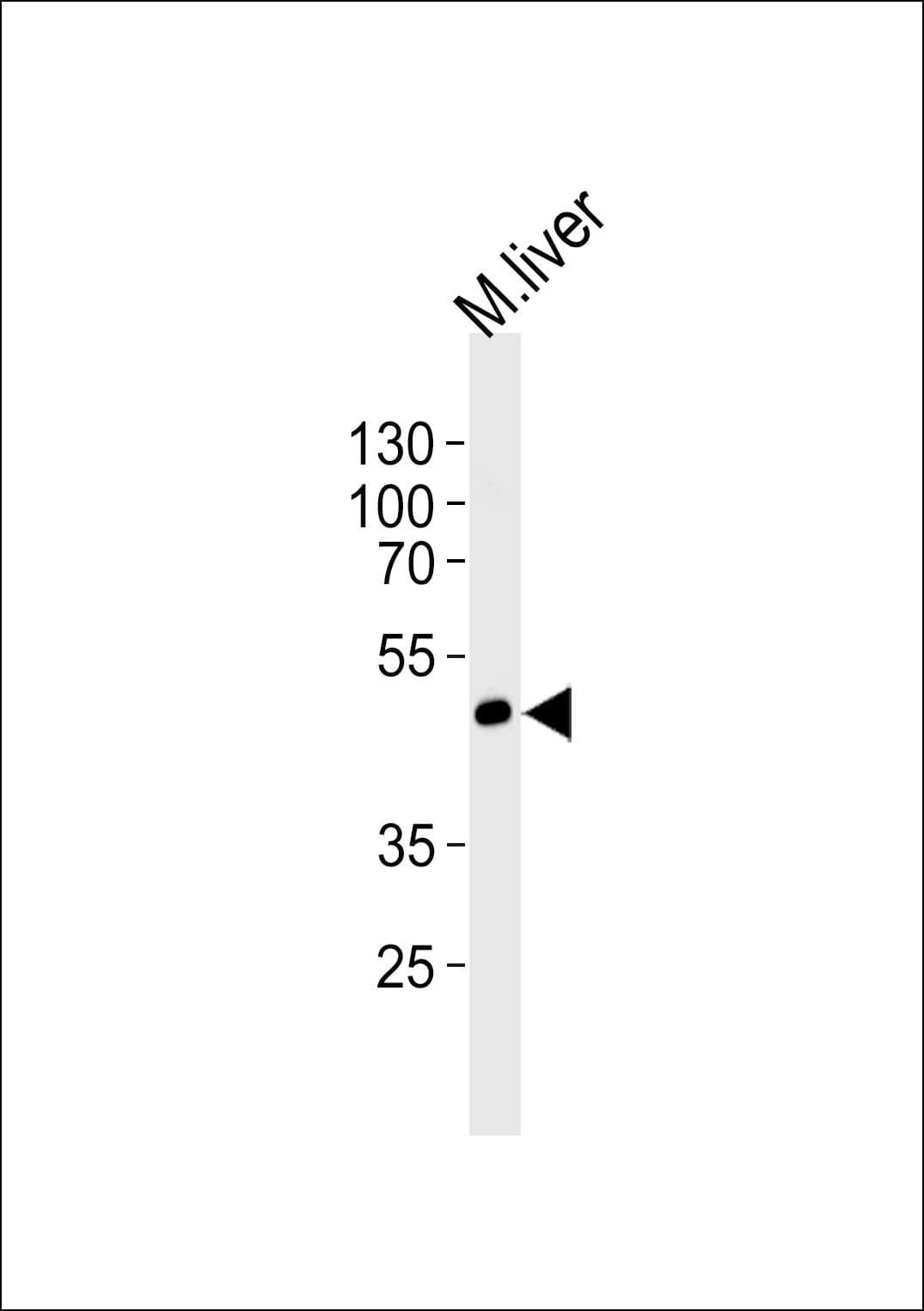 SHB Antibody (aa68-95)