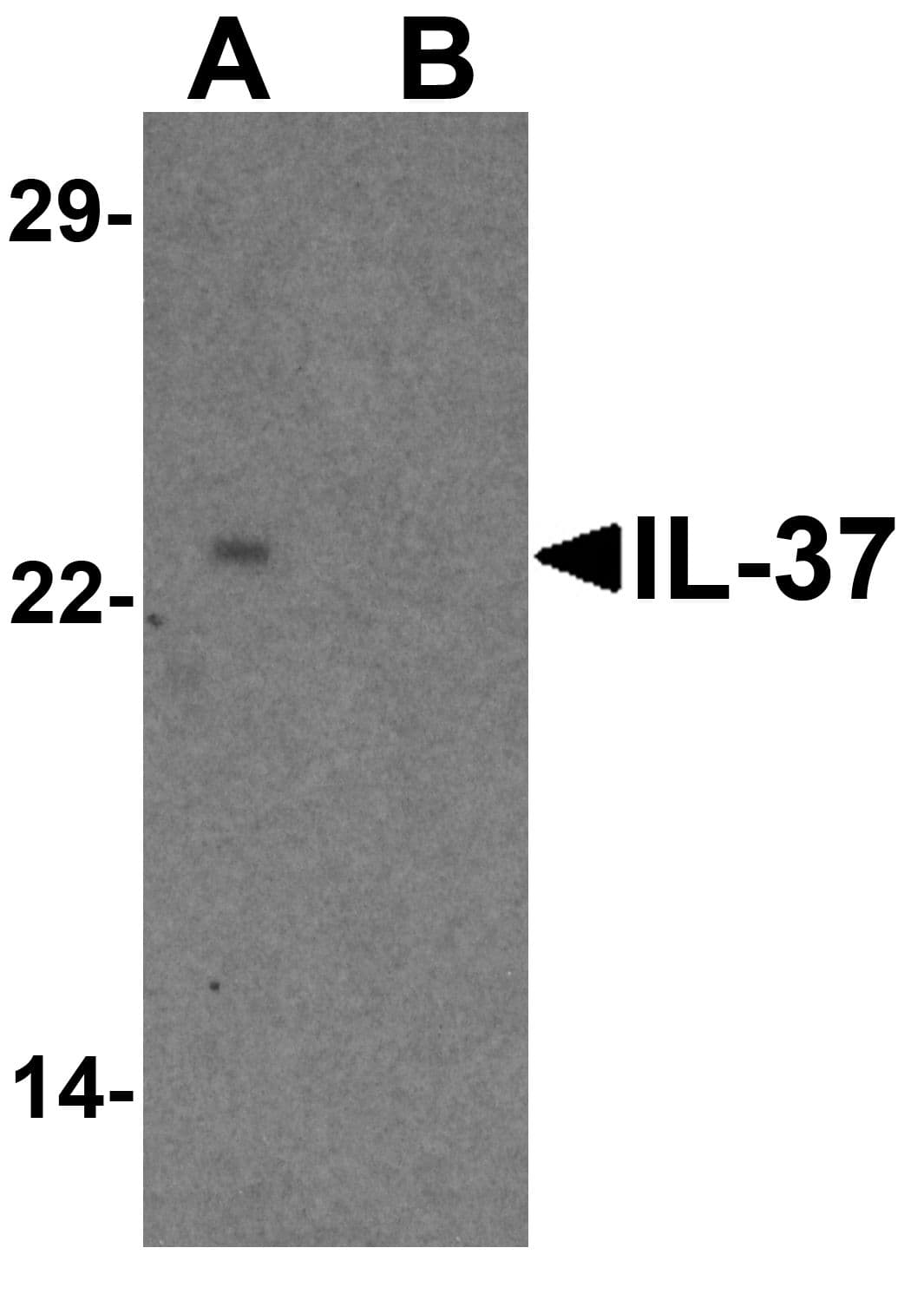 IHC-plus™ IL37 Antibody