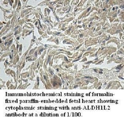 Polyclonal Rabbit anti-Human ALDH1L2 Antibody (aa2-247, IHC, WB)