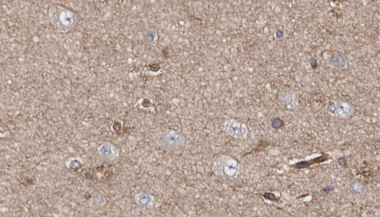 APBA2 Antibody
