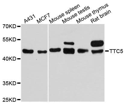 TTC5 Antibody