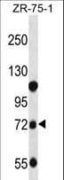 Polyclonal Rabbit anti-Human GUSB / Beta Glucuronidase Antibody (aa515-544, IHC, WB)