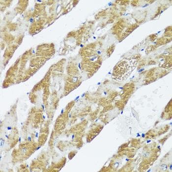 CASQ2 / Calsequestrin 2 Antibody