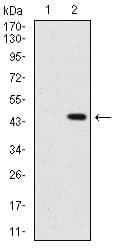 Monoclonal Mouse anti-Human SHH / Sonic Hedgehog Antibody (clone 5H4, IHC, WB)