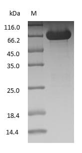 ALB / Serum Albumin Protein (Native)