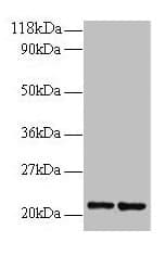 RPS9 / Ribosomal Protein S9 Antibody