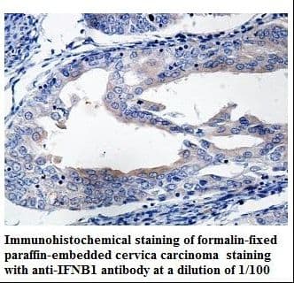 IFN Beta / Interferon Beta Antibody (aa23-187)