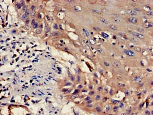 WASF1 / WAVE Antibody