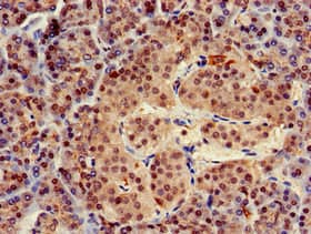 TRIM5 Antibody
