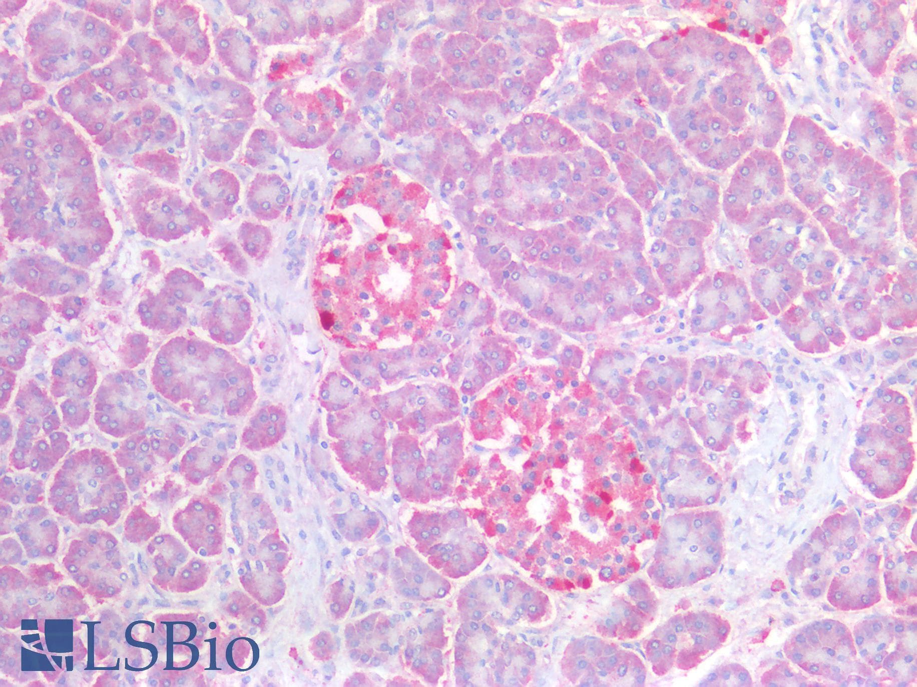 IHC-plus™ Polyclonal Rabbit anti-Human ADCY3 / Adenylate Cyclase 3 Antibody (IHC, IF, WB)