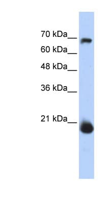 Polyclonal Rabbit anti-Human MIA40 / CHCHD4 Antibody (N-Terminus, WB)