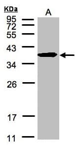 Polyclonal Rabbit anti-Human SPFH2 / ERLIN2 Antibody (aa278-339, IHC, WB)