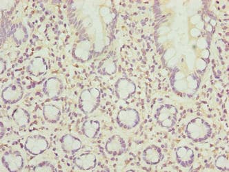 Polyclonal Rabbit anti-Human SCAPER Antibody (IHC)