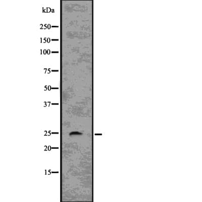RHOQ / TC10 Antibody