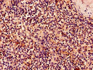 KLRK1 / CD314 / NKG2D Antibody