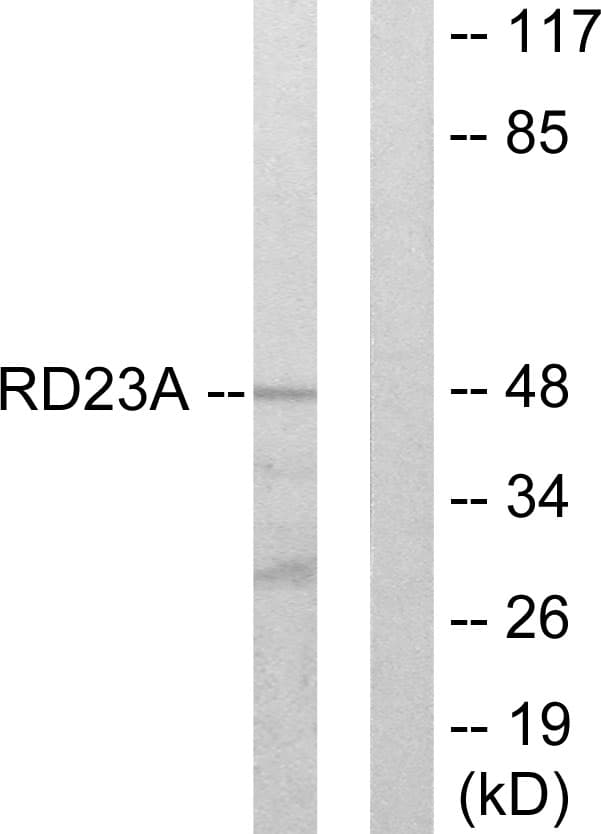 Polyclonal Rabbit anti-Human RAD23A / HHR23A Antibody (aa91-140, WB)