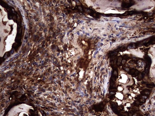 Monoclonal Mouse anti-Human CEACAM5 / CD66e Antibody (clone OTI3D8, aa35-680, IHC, WB)