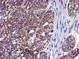 LIMK1 / LIMK Antibody (clone OTI6B4)