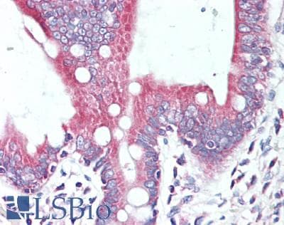 STK38 Antibody