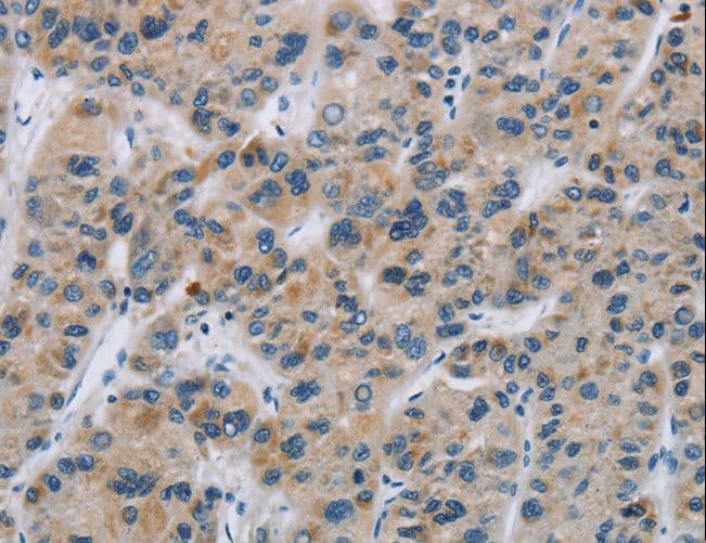 Polyclonal Rabbit anti-Human SYN2 / Synapsin II Antibody (IHC, WB)