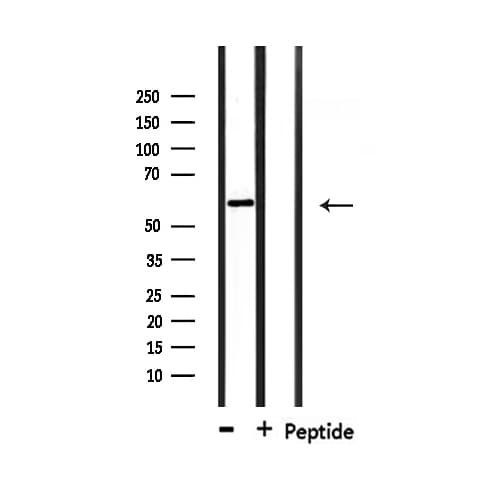 TKFC / DAK Antibody